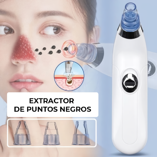 ESTRACTOR DE PUNTOS NEGROS-NAGADA